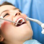 Best Considerations to Make Before Using the Services of a Dentist